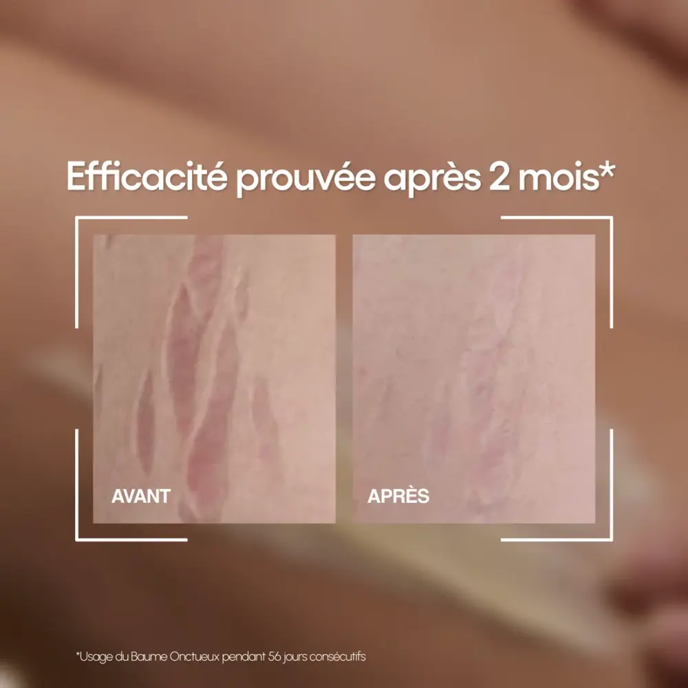 le baume onctueux soin correcteur 3 en 1 | 200ml